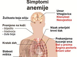 simptomi anemije