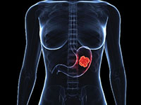 zeludac cir zeludac cir