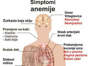 simptomi anemije