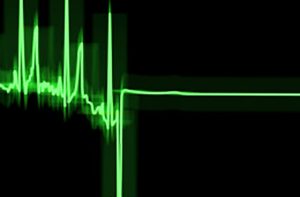 Preminuo učitelj glume Aleksić optužen za silovanje