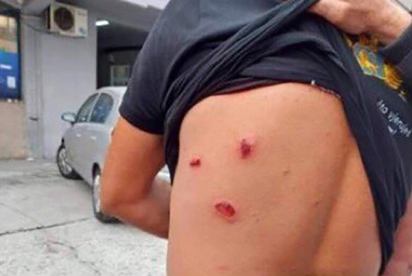 Više demonstranata povrijeđeno