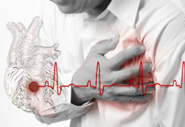 Konzumacija šampanjca može da smanji rizik od iznenadnog srčanog udara