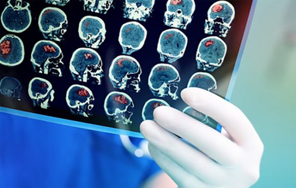 Turčin zaboravio turski, a progovorio danski