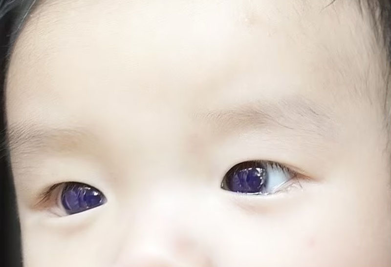 Kako zaustaviti očevo hrkanje