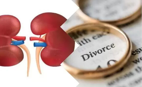 razvod bubreg