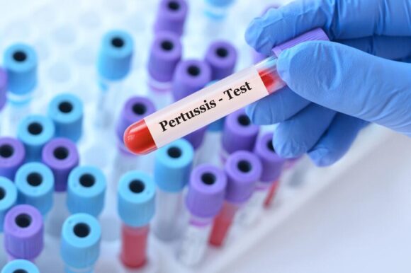 veliki kasalj test